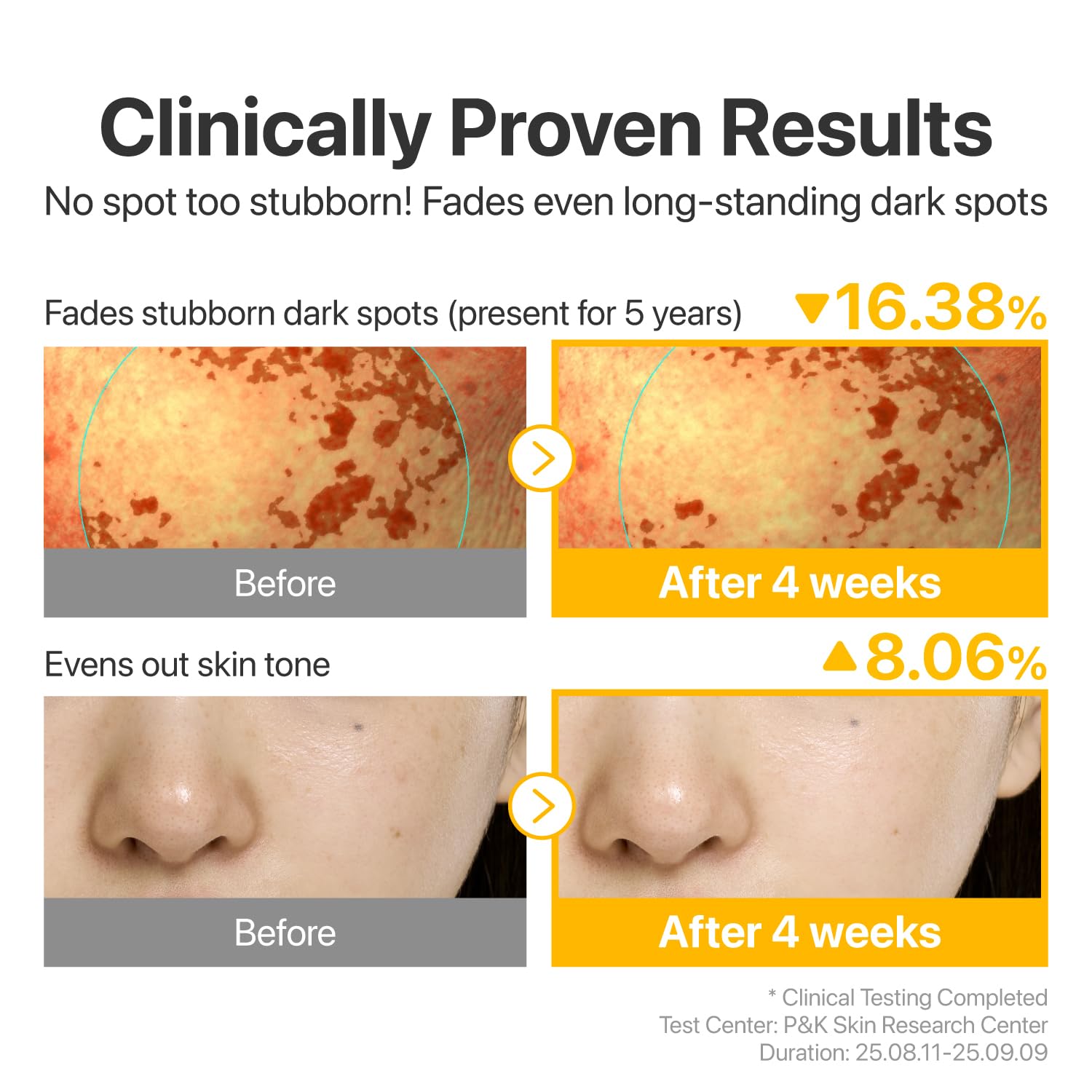 Numbuzin No.5 Ampoule before after 2 weeks – dark spots fade melasma sun damage post-acne marks even tone radiant glow targeted treatment
