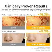 Numbuzin No.5 Ampoule before after 2 weeks – dark spots fade melasma sun damage post-acne marks even tone radiant glow targeted treatment