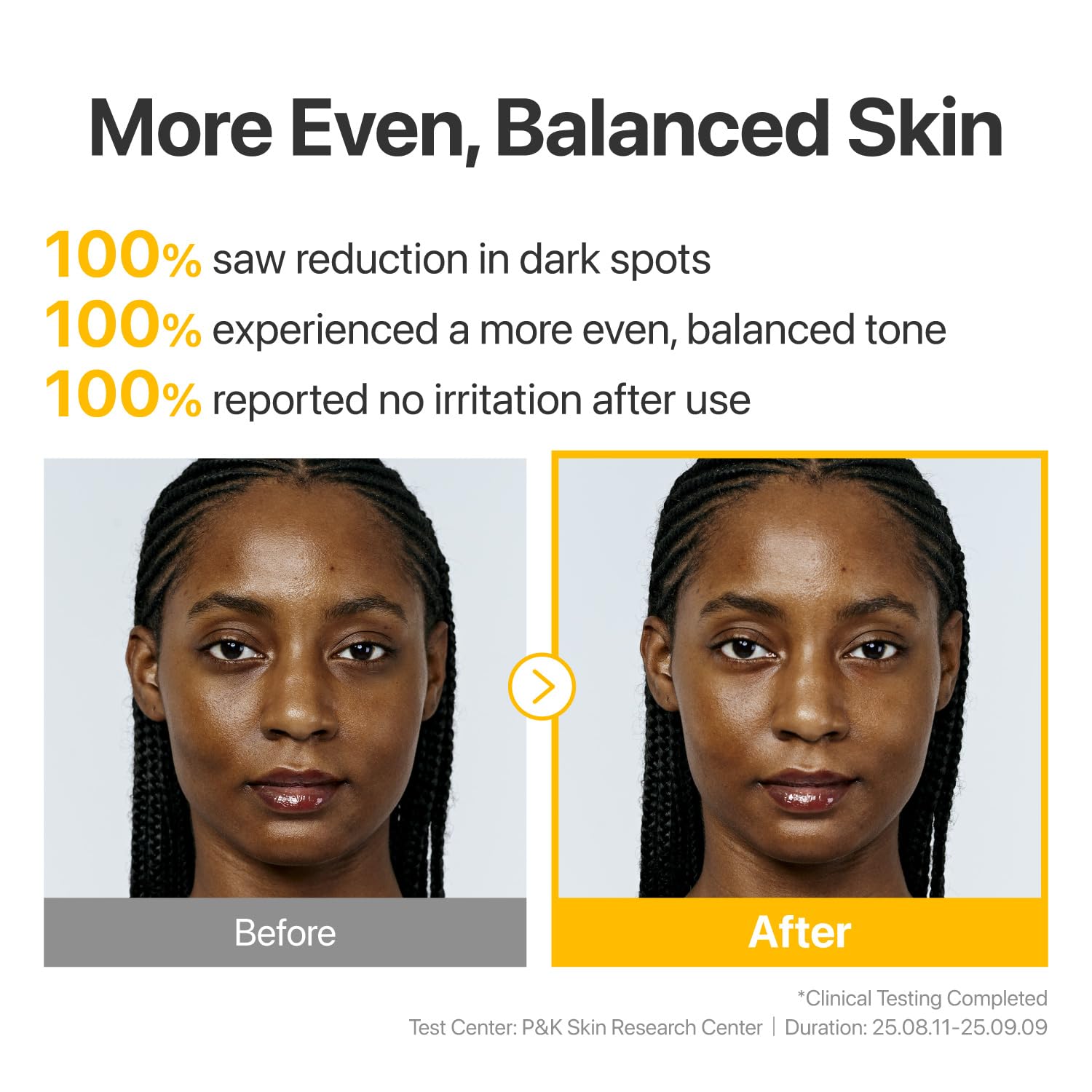Numbuzin No.5 Ampoule Glutathione TXA triple brightening – melanin convert interrupt block three pathways dark spots melasma sun damage fade
