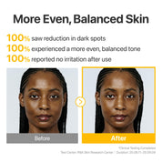 Numbuzin No.5 Ampoule Glutathione TXA triple brightening – melanin convert interrupt block three pathways dark spots melasma sun damage fade
