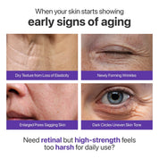 Numbuzin No.9 NAD Retinal Volumetox Eye Cream (Tube)