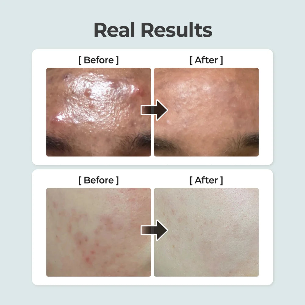 Numbuzin No.1 Herb Toner key ingredients – centella asiatica heartleaf licorice extract fragrance-free Korean toner