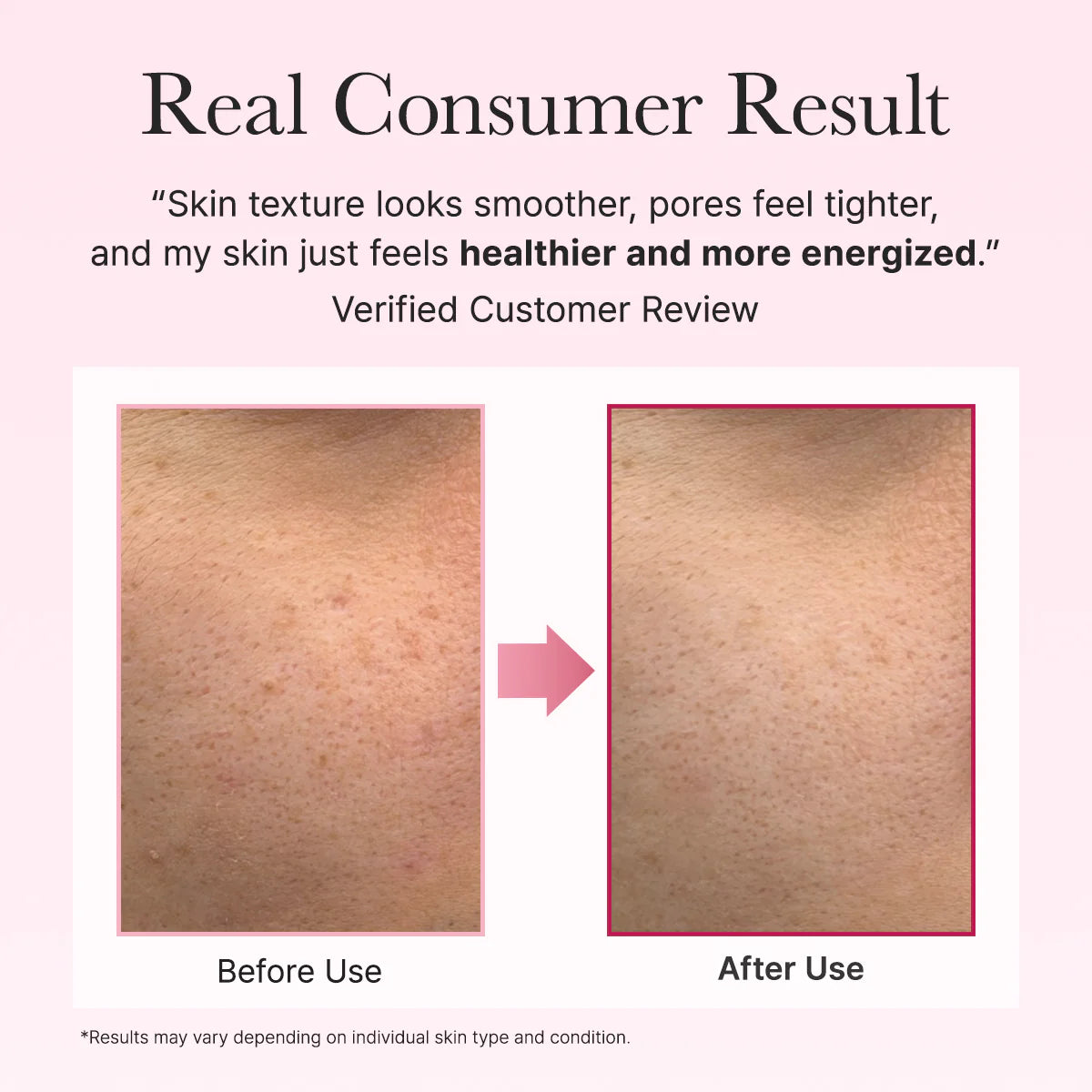 Arencia PDRN Booster Shot