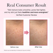 Arencia PDRN Booster Shot