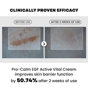 PRO-CALM EGF Active Cream texture – lightweight pharmacy-grade barrier repair sensitive post-treatment skin 20ml