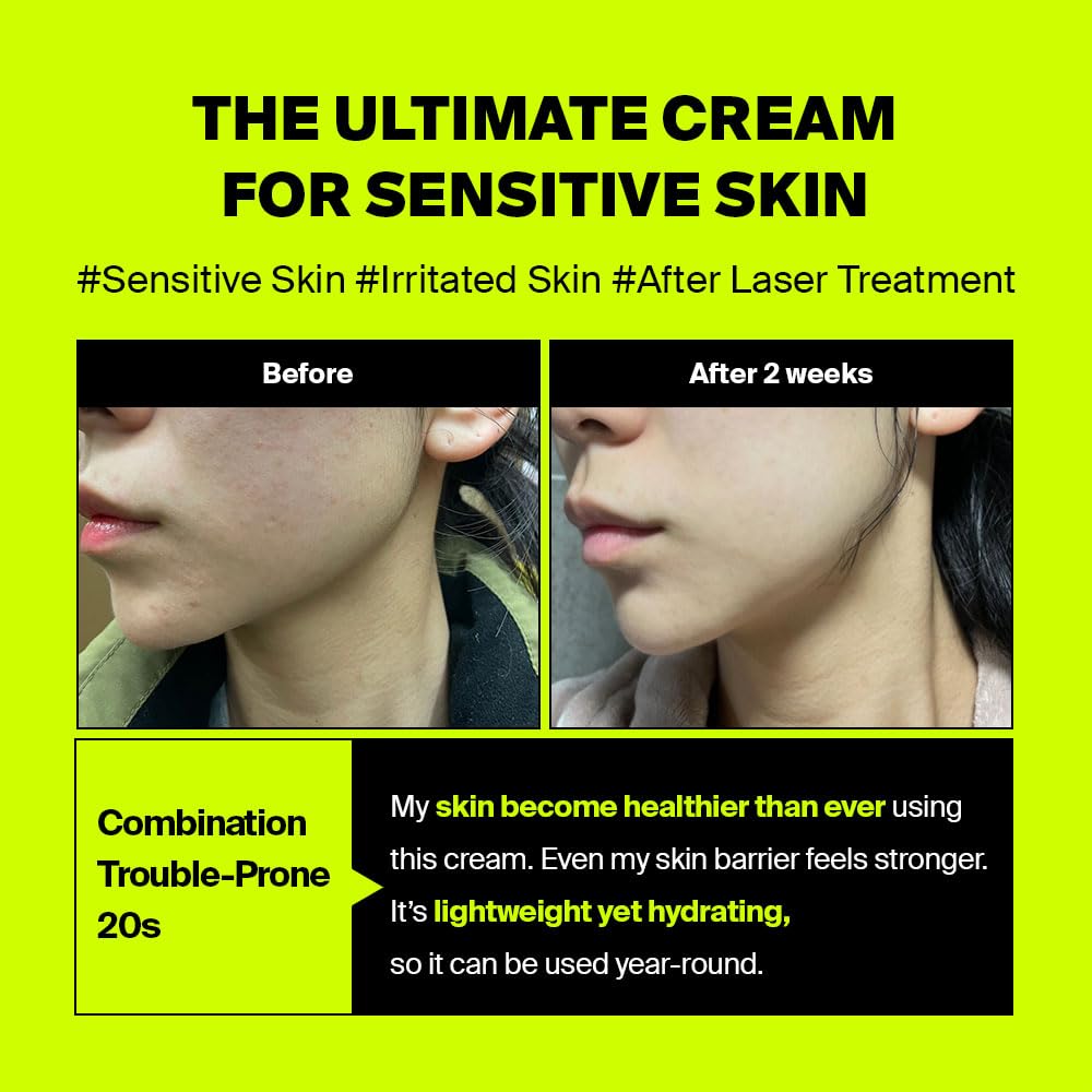 Purcell After Laser Cream barrier repair – Niacinamide Panthenol Squalane Meadowfoam Cupuaçu Butter Centella probiotic microbiome