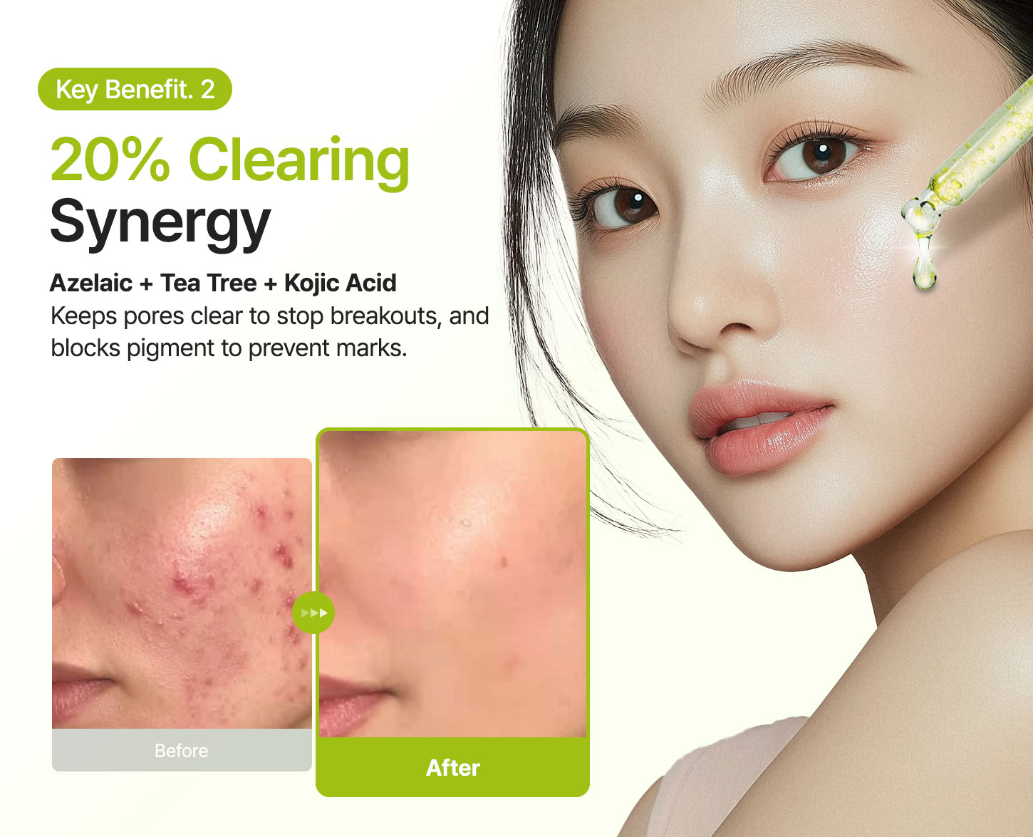 Purito Seoul Azelaic Acid 10 Kojic Tea Tree Serum