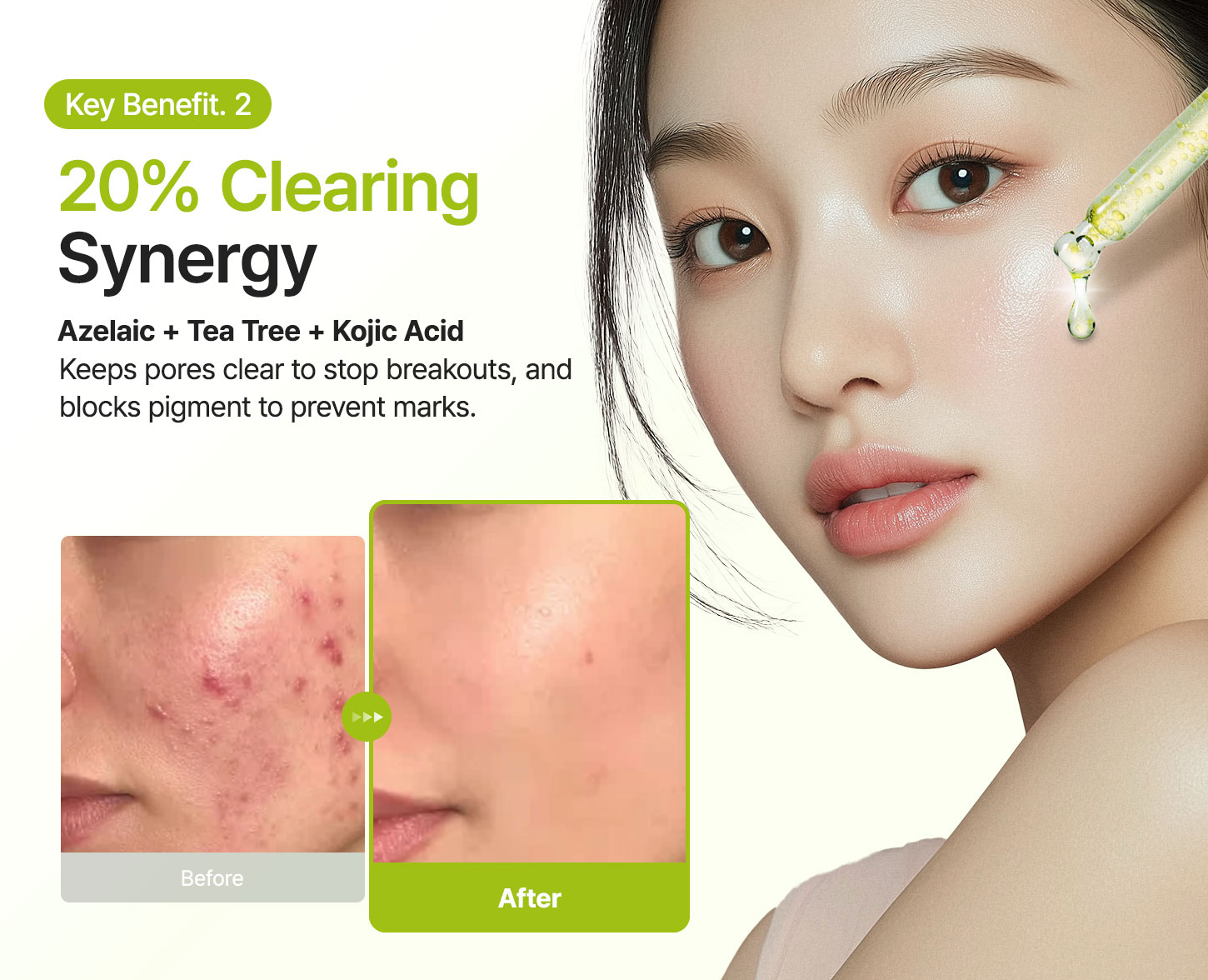Purito Seoul Azelaic Acid 10 Kojic Tea Tree Serum – Korean Acne