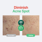 Purito Centella Unscented Serum on Purito Centella Unscented Serum before after – reduced redness calmed inflammation barrier repair Korean cica serum