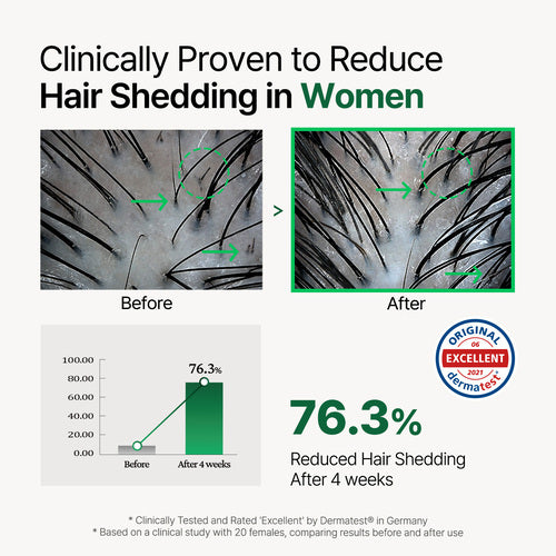 Rooton Alpha Erguen Hair Tonic