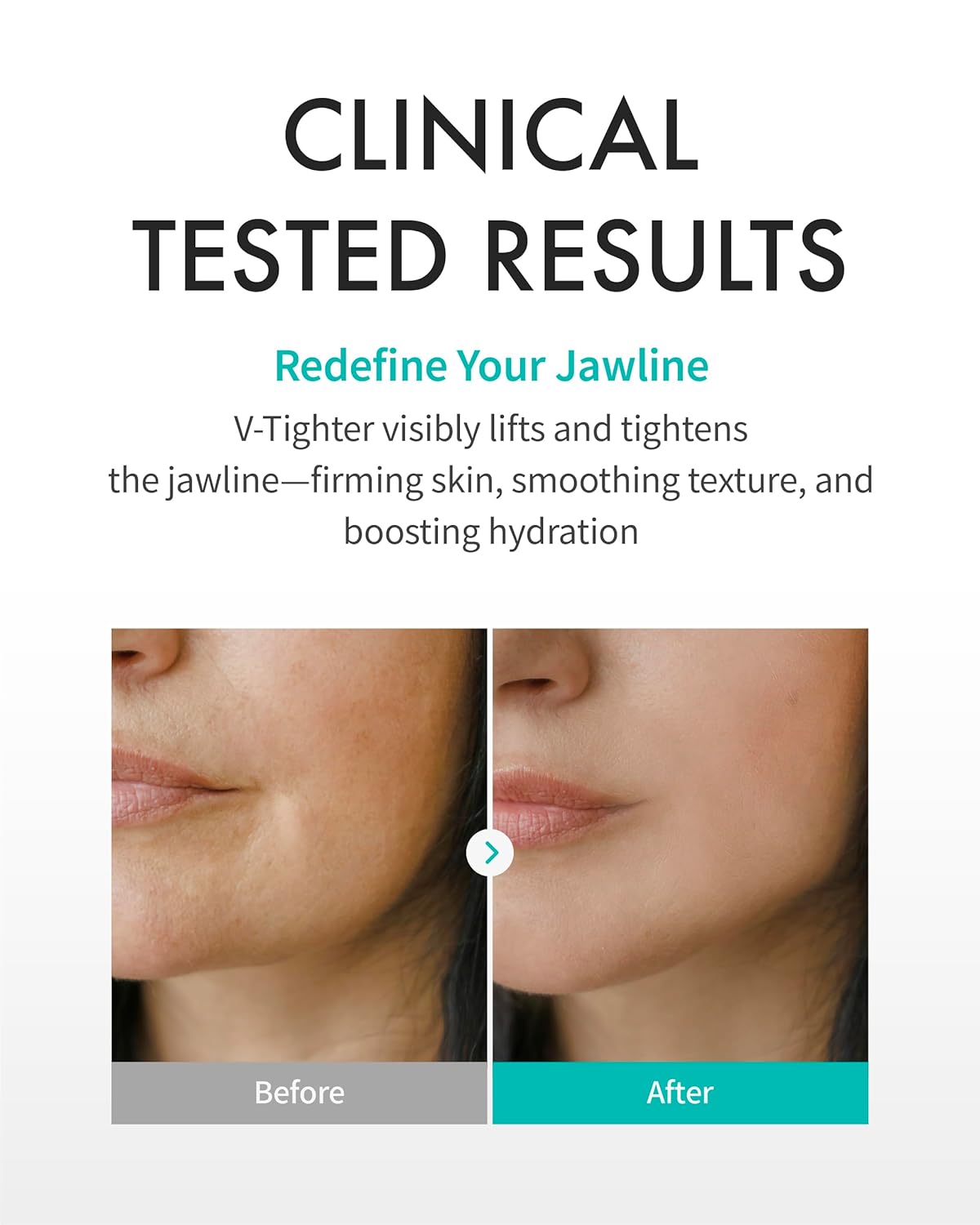 Rejuran Perfect V Tighter Mask Box