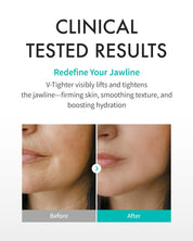 Rejuran Perfect V Tighter Mask Box