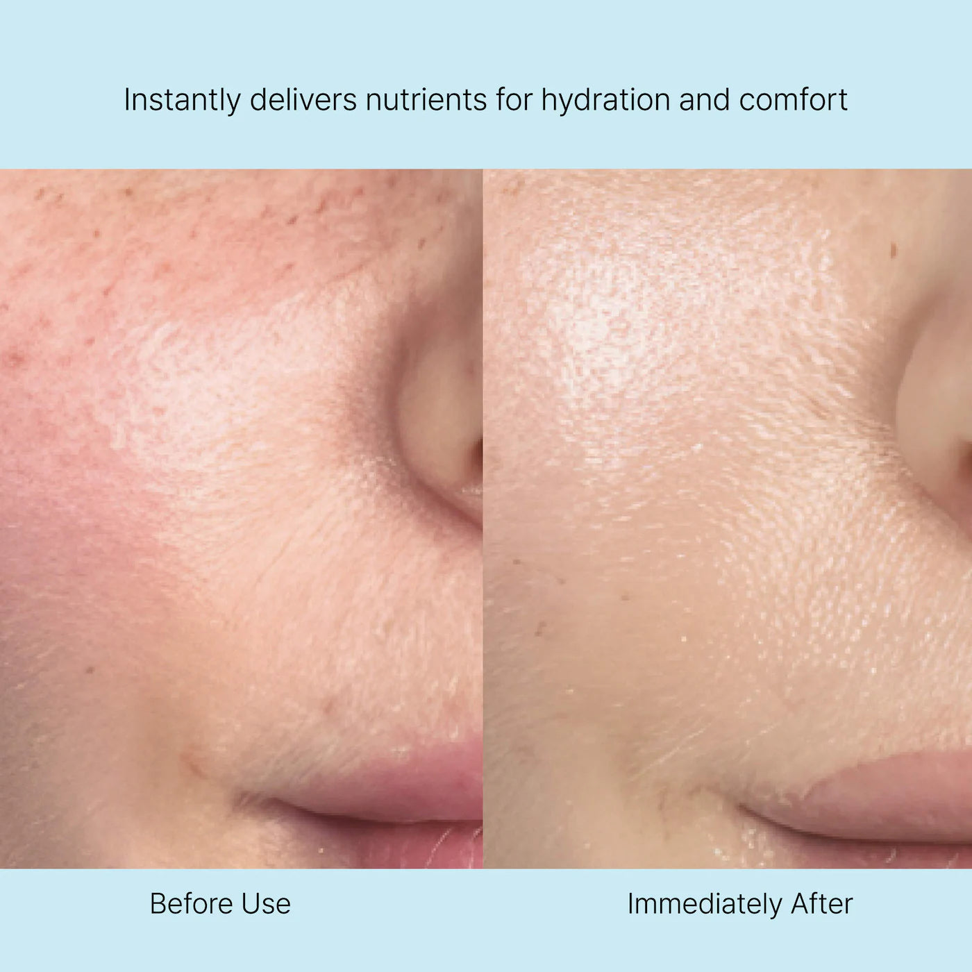 Rejuran Nutritive Cream how to use – after toner serum apply face neck massage absorb morning evening AM PM has fragrance 50ml routine