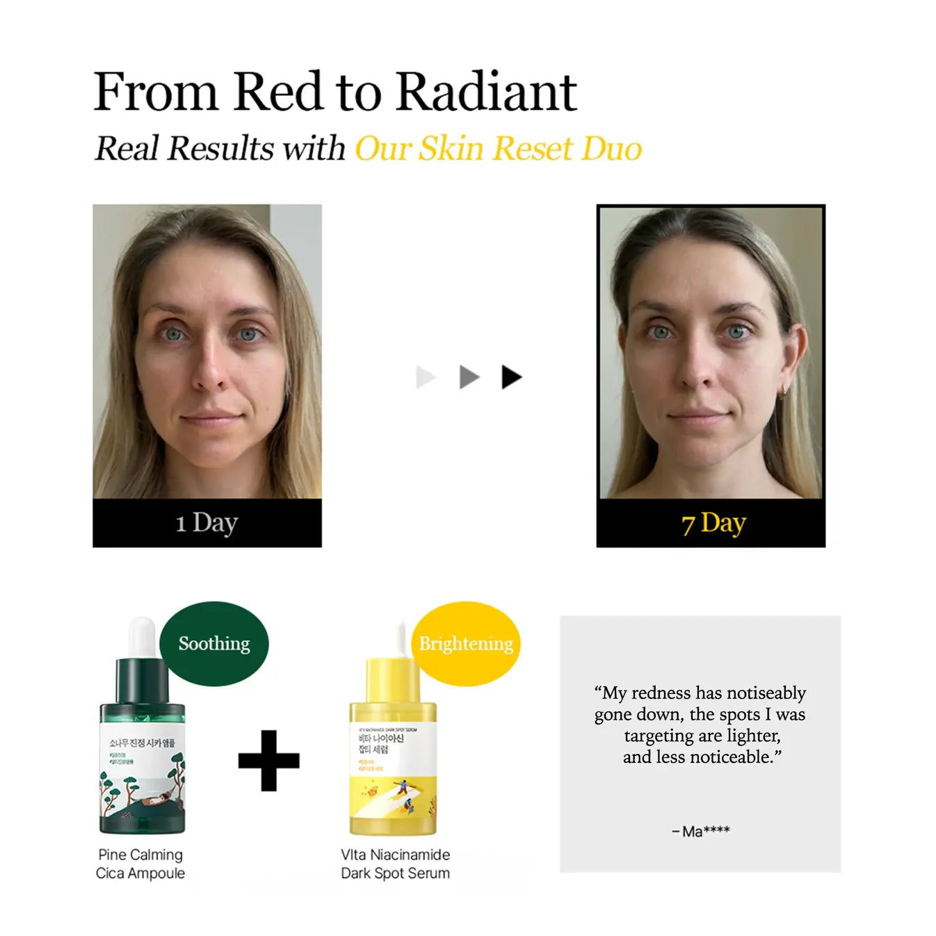 
Round Lab Vita Niacinamide Dark Spot Serum $24 – Centella Purslane Panthenol calm repair fragrance-free vegan AM PM rosacea Olive Kollection