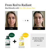 
Round Lab Vita Niacinamide Dark Spot Serum $24 – Centella Purslane Panthenol calm repair fragrance-free vegan AM PM rosacea Olive Kollection