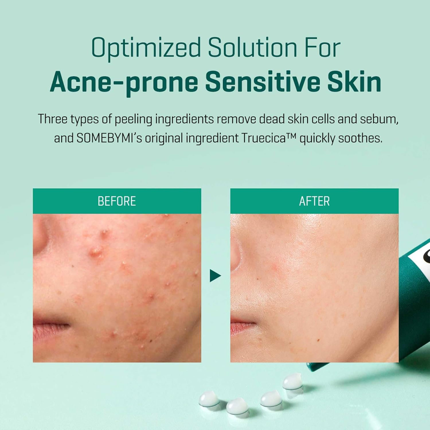 Some By Mi Spot All Kill AHA BHA PHA – triple acid exfoliation resurface pore clear sebum gently hydrating spot treatment