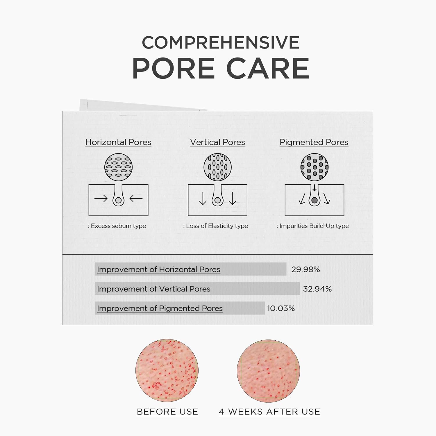 Skin 1004 Niacinamide 10 Boosting Shot spicule texture – gel formula micro-spicules suspended massage face mild tingle absorb deeper than regular serum