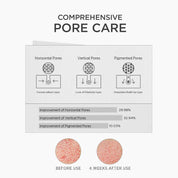 Skin 1004 Niacinamide 10 Boosting Shot spicule texture – gel formula micro-spicules suspended massage face mild tingle absorb deeper than regular serum