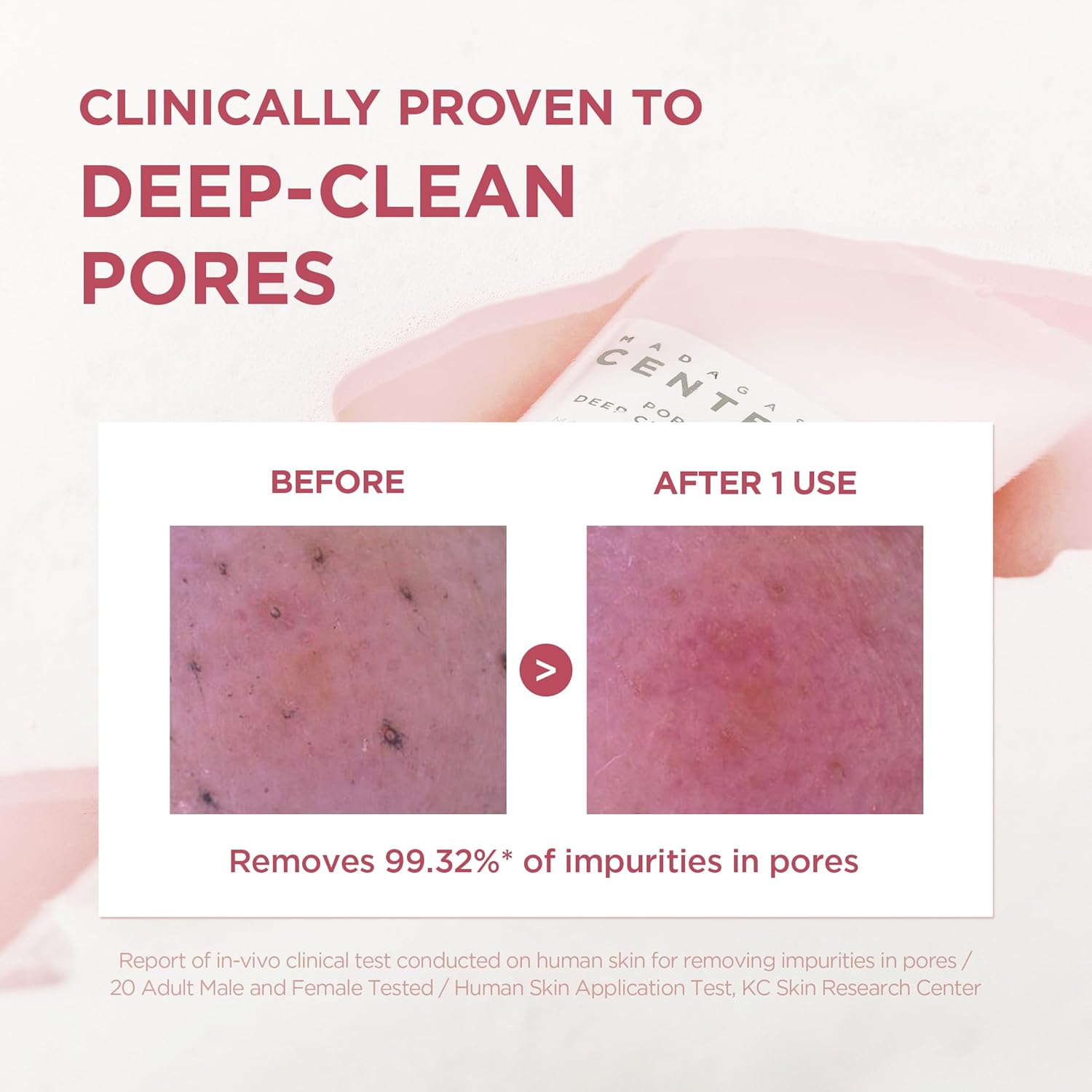 Skin 1004 Poremizing Foam texture – thick cream paste to rich dense foam pea-sized amount massage rinse deep clean oily acne-prone skin