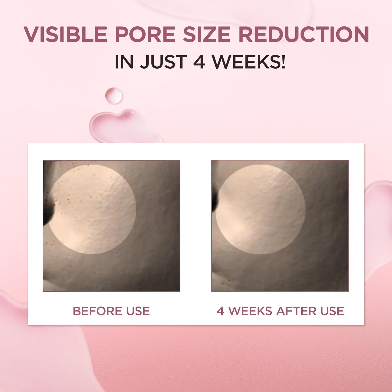 Skin1004 Poremizing Ampoule results – visibly smaller pores firmer hydrated skin Korean 9 peptides Centella ampoule