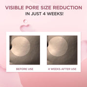 Skin1004 Poremizing Ampoule results – visibly smaller pores firmer hydrated skin Korean 9 peptides Centella ampoule