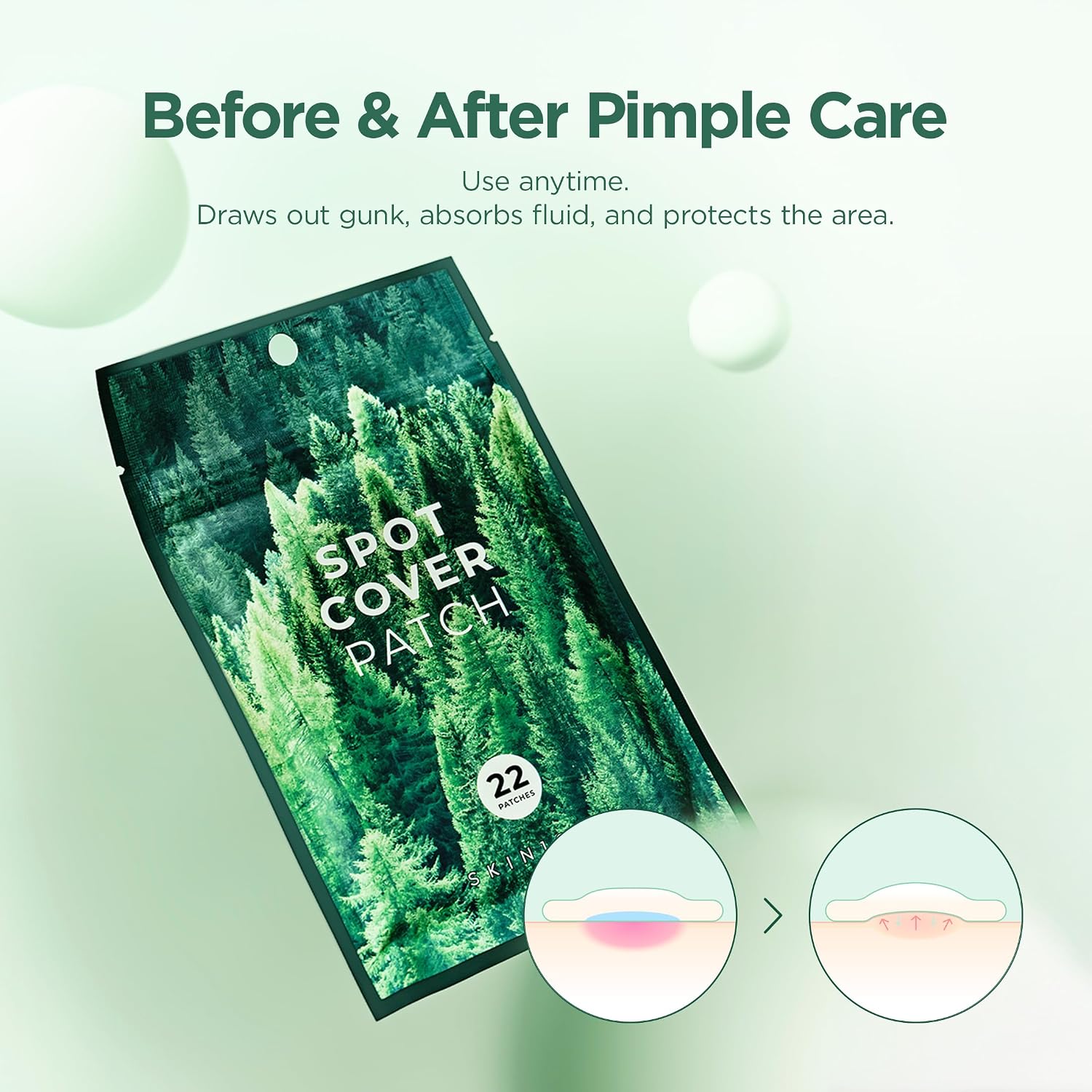 Skin1004 Spot Cover Patch on skin – thin transparent hydrocolloid absorbs impurities turns white nearly invisible Korean