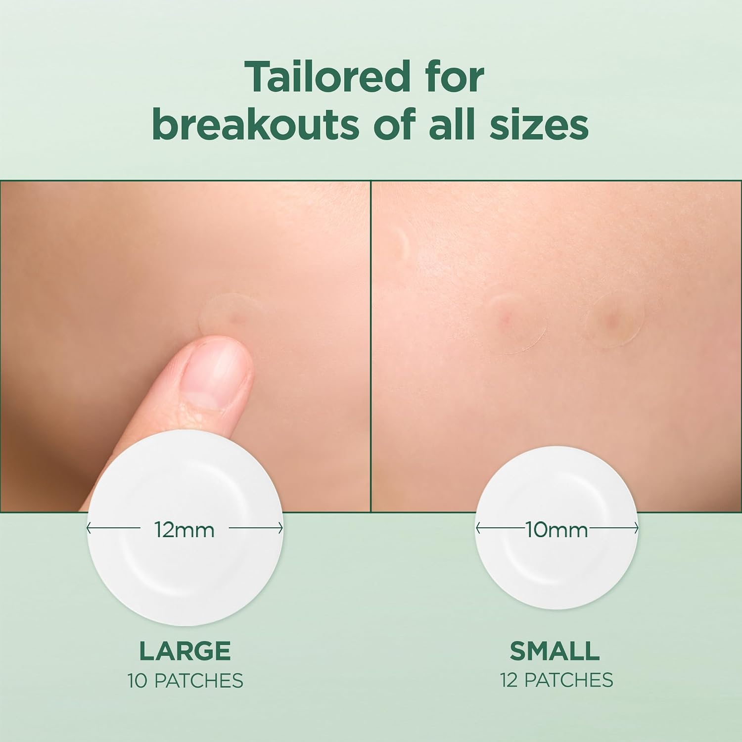 Skin1004 Tea-Trica Spot Cover Patch 22 patches – waterproof under makeup vegan 4 reviews 5.0 stars Korean Olive Kollection