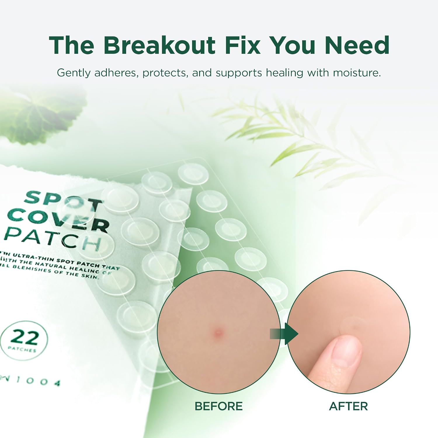 Skin1004 Tea-Trica Spot Patch application – peel press 2-3 seconds clean dry skin blemish cover Korean acne patch
