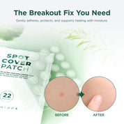 Skin1004 Tea-Trica Spot Patch application – peel press 2-3 seconds clean dry skin blemish cover Korean acne patch