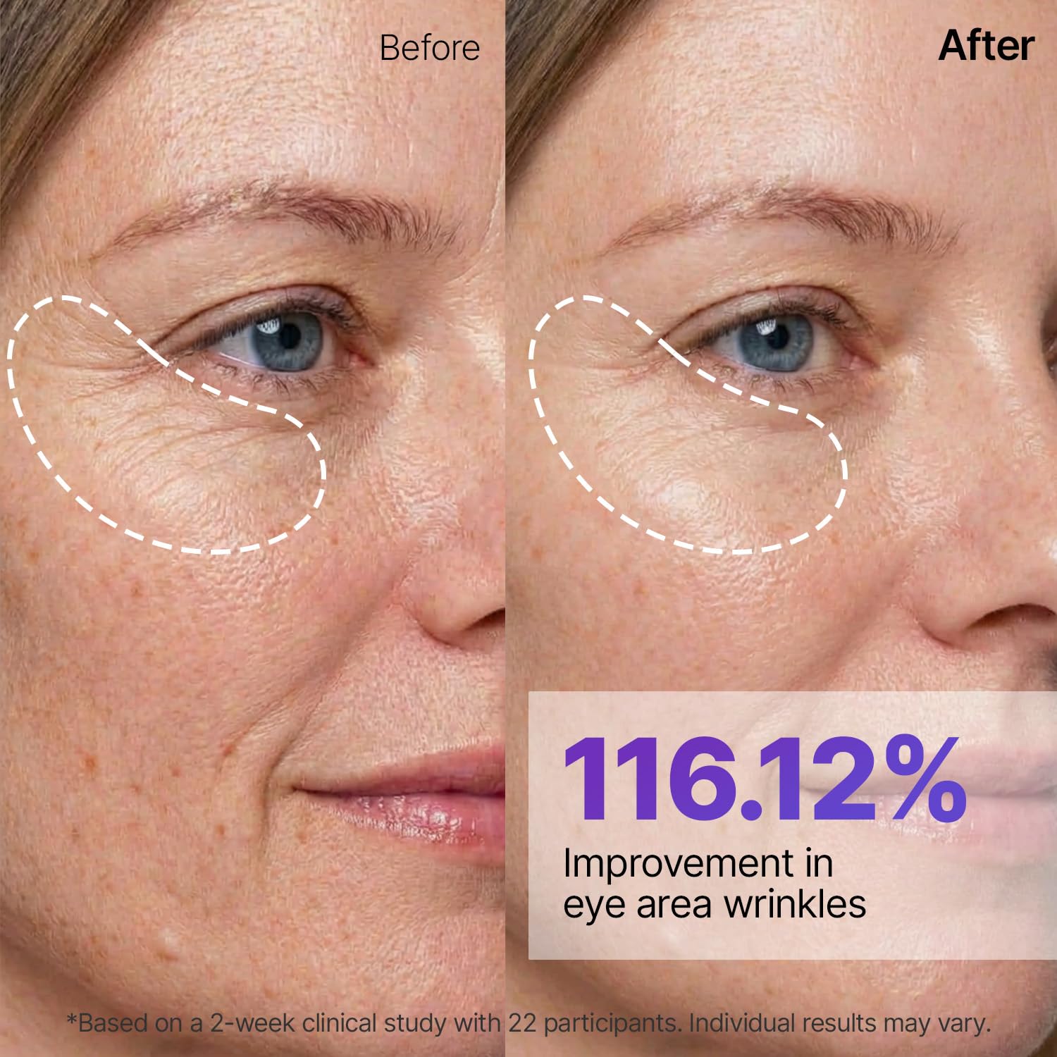 Sungboon Editor Deep Collagen Silk Peptide EGF Intensive Gold Mask