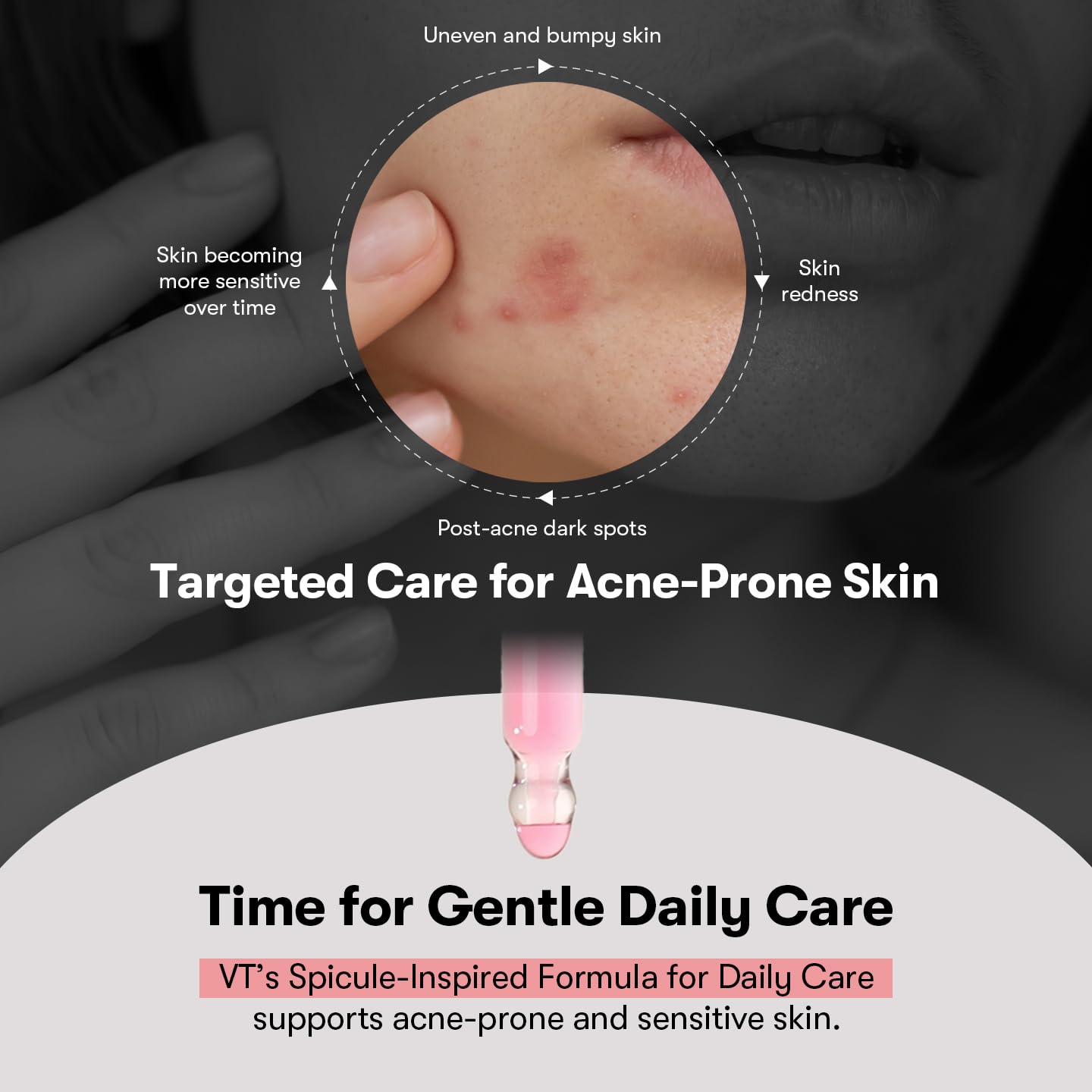 VT Azelaic Acid Ampoule Cica Exosome technology – nano Centella vesicles deeper delivery micro-particle absorption Korean