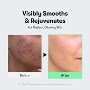 VT Reedle Shot strength levels – 50 mild 100 intermediate 300 strongest Korean spicule serum texture refinement