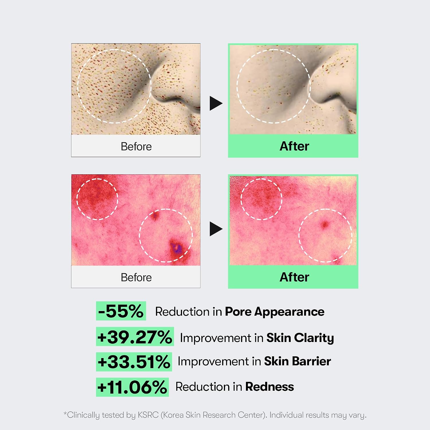 VT Reedle Shot 100 key ingredients – Niacinamide Adenosine Green Propolis 15 amino acids Macadamia Oil Korean spicule serum