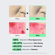 VT Reedle Shot 100 key ingredients – Niacinamide Adenosine Green Propolis 15 amino acids Macadamia Oil Korean spicule serum