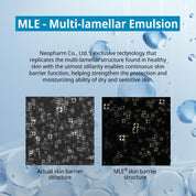 Zeroid Soothing Cream 160 ml