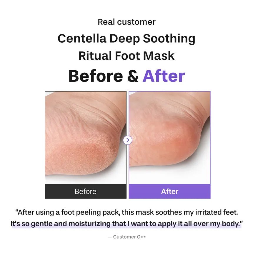 Baren Centella Foot Mask booties for dry cracked feet