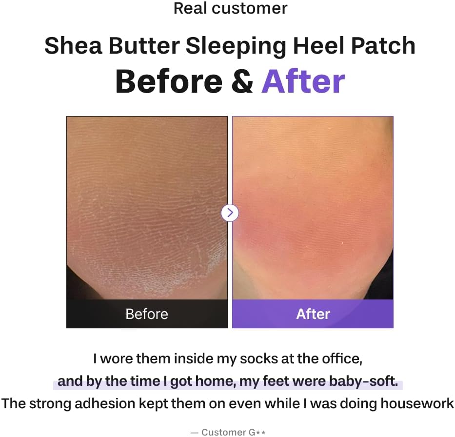 baren Sleeping Heel Patch 2-pack – 10 patches per pack cracked dry rough heels Salicylic Acid LHA PHA overnight soften nourish