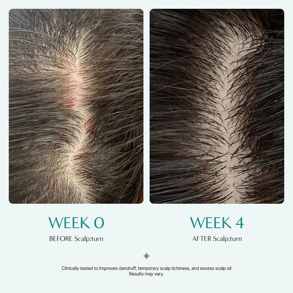 Lilyeve Scalp: Turn Cica PDRN Brush Ampoule