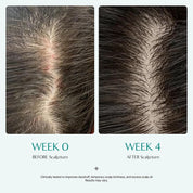 Lilyeve Scalp: Turn Cica PDRN Brush Ampoule