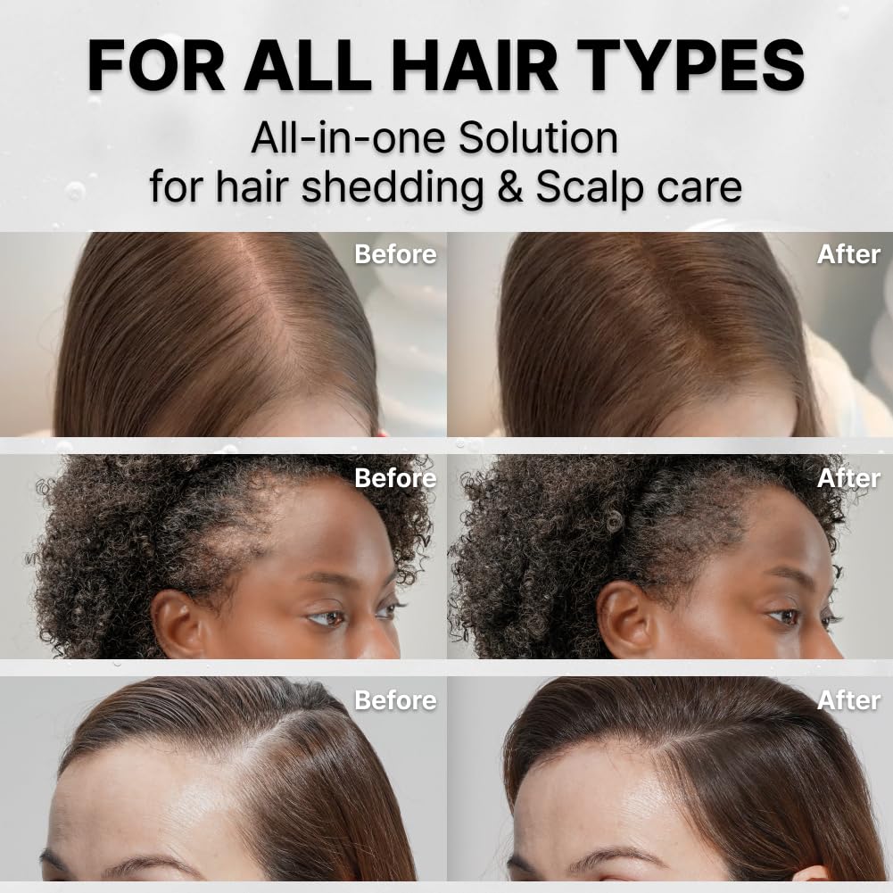 lilyeve Grow Turn Ampoule 100ml