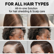 lilyeve Grow Turn Ampoule 100ml