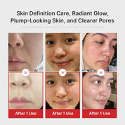 Medicube Age-R Booster Pro Pink