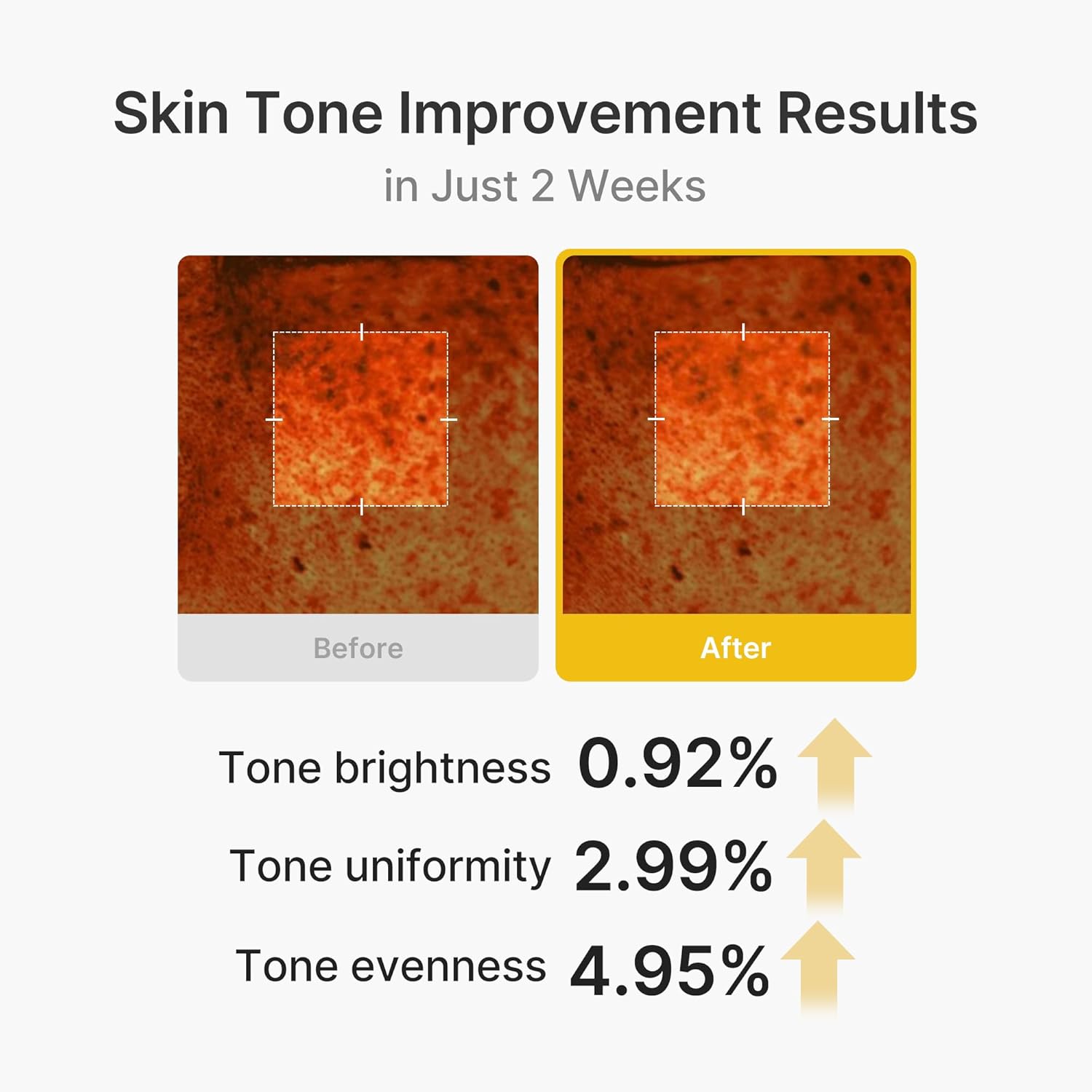 Medicube Kojic Acid Capsule Cream clinical – 43.48% radiance improvement after one use 8 HA types ceramide NP allantoin hydration barrier
