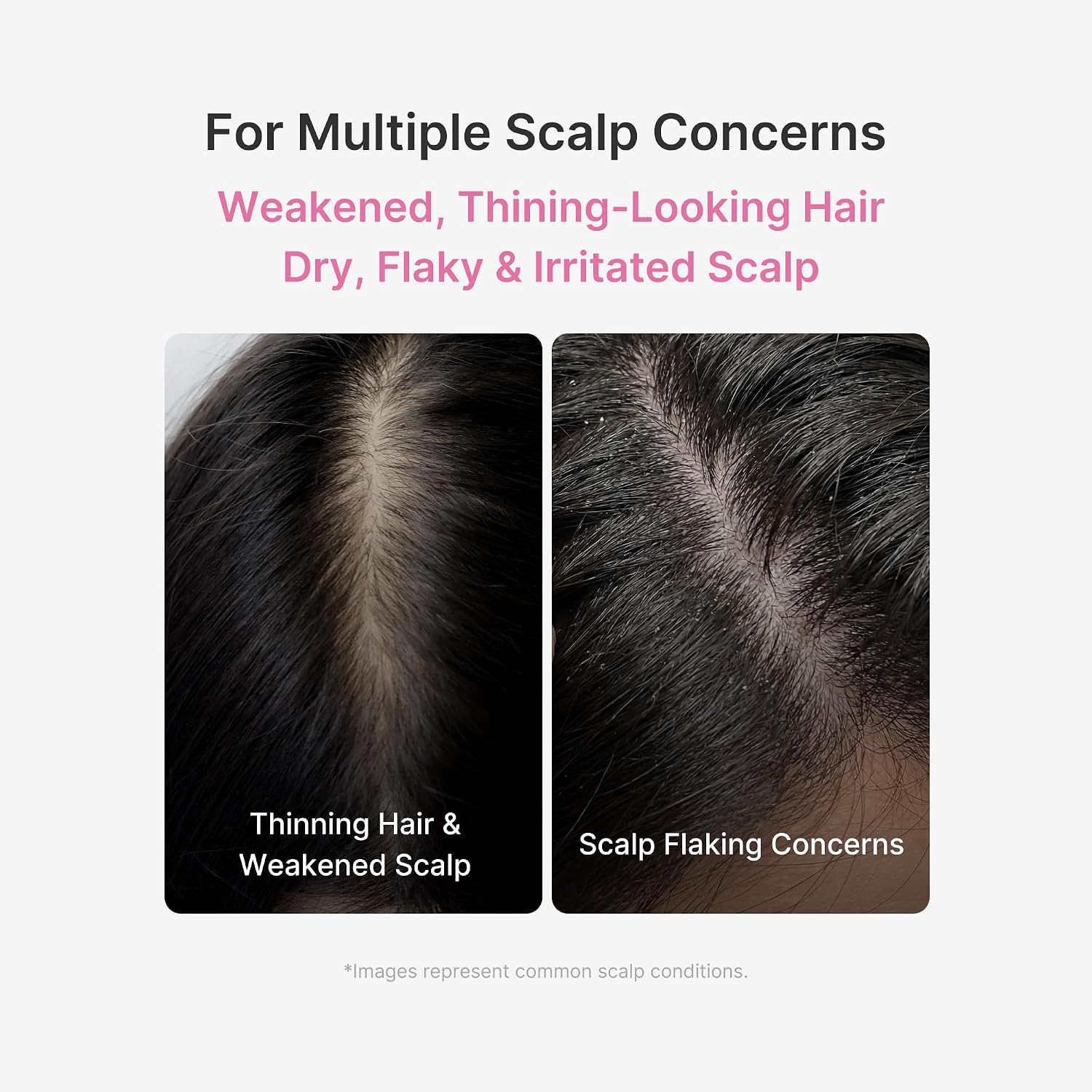 Medicube Scalp Serum on scalp – lightweight leave-on treatment flake-prone thinning fine hair daily use Korean haircare