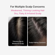 Medicube Scalp Serum on scalp – lightweight leave-on treatment flake-prone thinning fine hair daily use Korean haircare