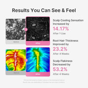 Medicube Scalp Serum proteins – 6 hydrolyzed proteins Pea Corn Potato Rice Soy AHA BHA PHA scalp exfoliation Korean