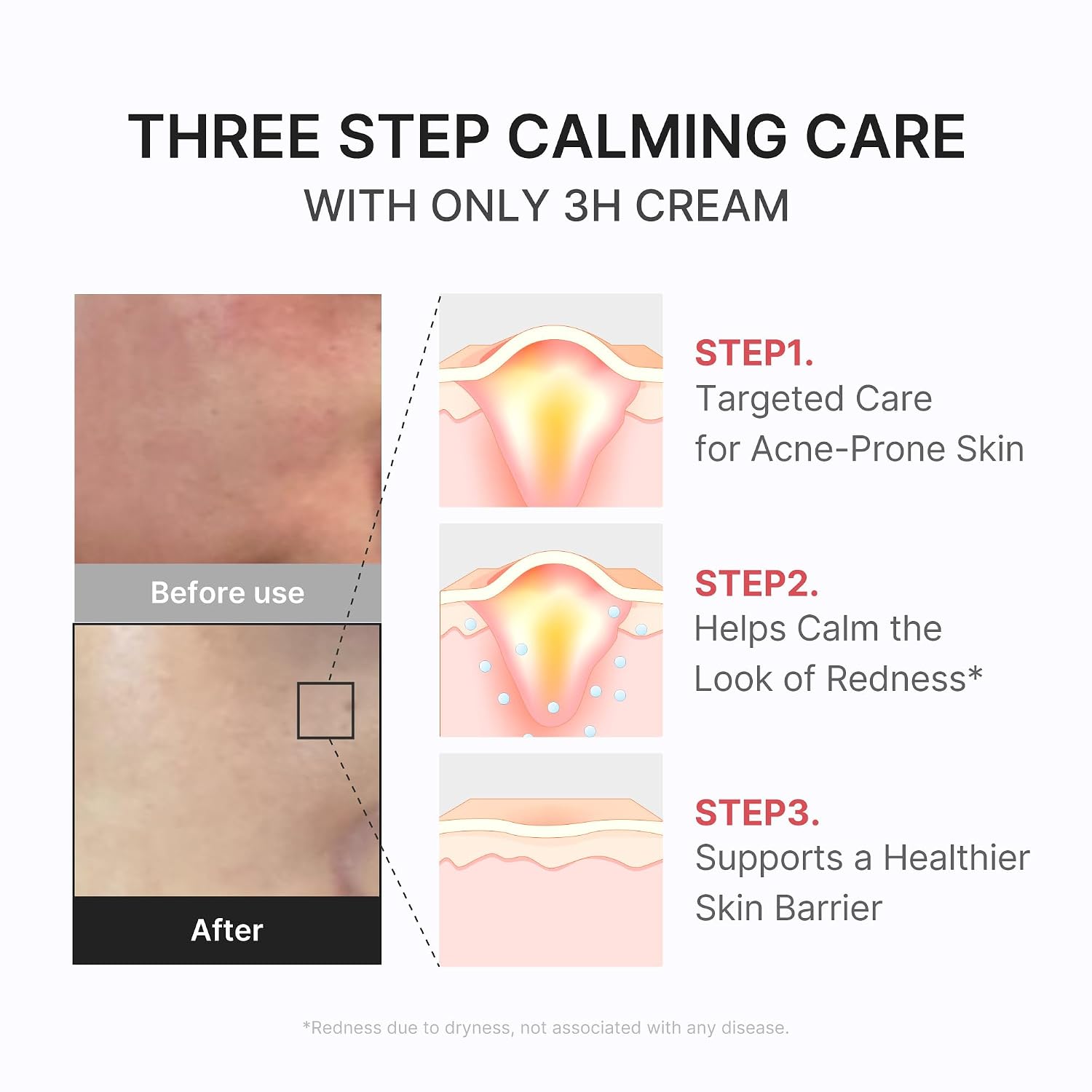 Medicube 3H Cream on skin – soothes redness calms breakouts barrier recovery 22 ingredients Korean sensitive skincare