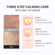 Medicube 3H Cream on skin – soothes redness calms breakouts barrier recovery 22 ingredients Korean sensitive skincare