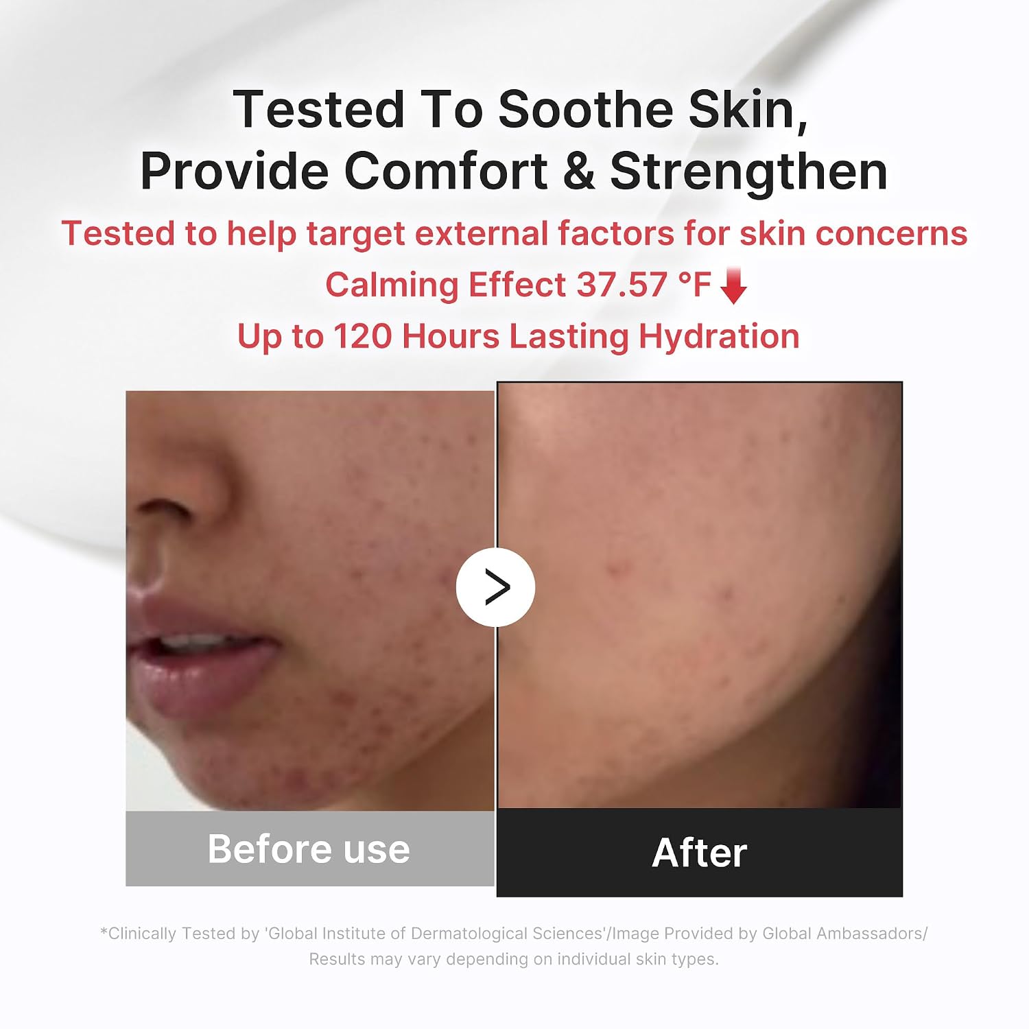Medicube 3H Cream texture – lightweight jelly-cream non-sticky absorbs fast calming soothing sensitive breakout-prone Korean