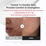 Medicube 3H Cream texture – lightweight jelly-cream non-sticky absorbs fast calming soothing sensitive breakout-prone Korean